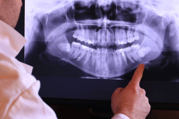 Best Emergency Tooth Extraction  in Surfside, FL