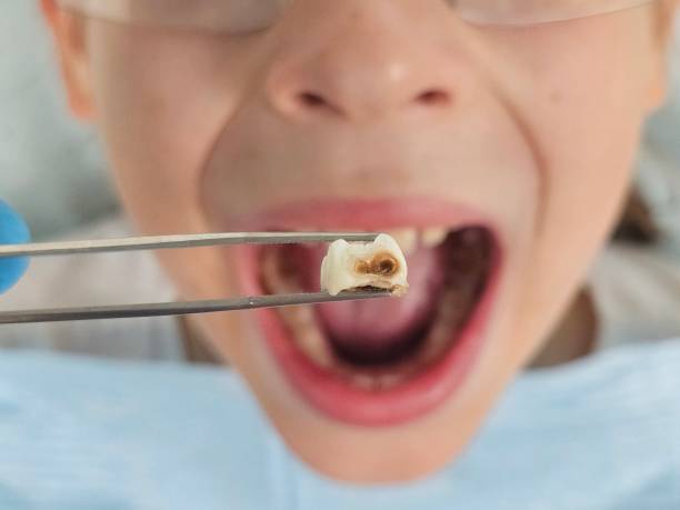 Best Emergency Pediatric Dentist  in Surfside, FL