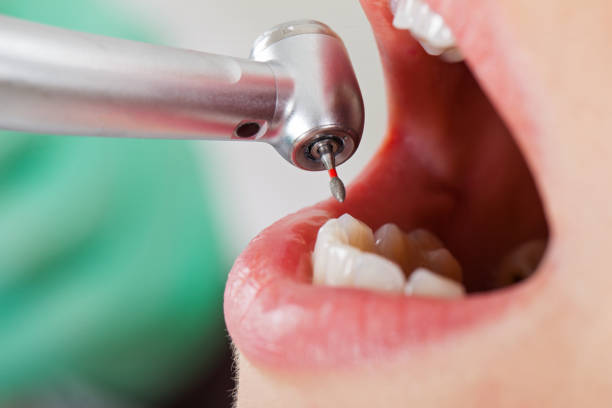 Best Urgent Tooth Repair  in Surfside, FL